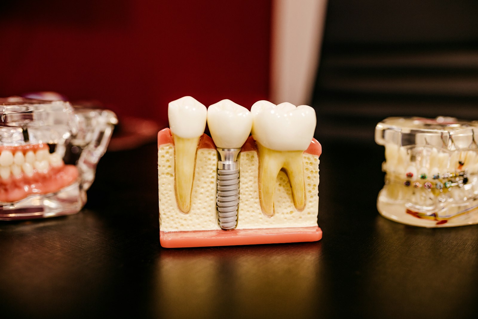 Precision dental restoration model and instruments
